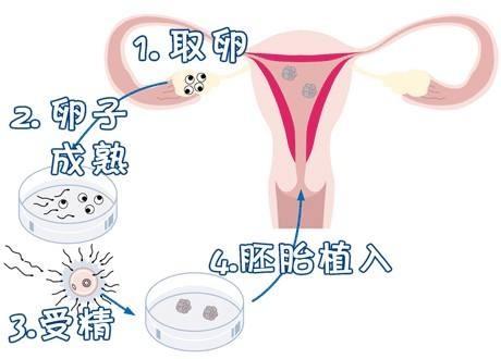 助孕儿子包成功